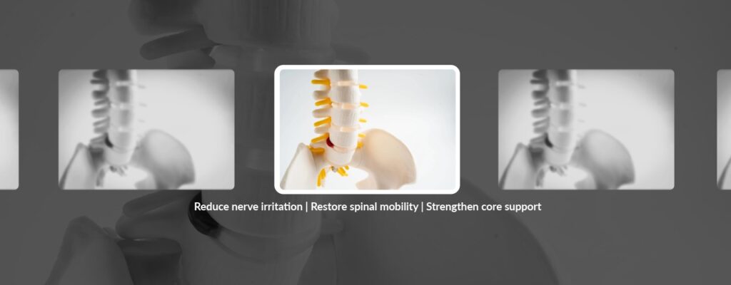 How to Know If Your Back Pain Is Caused by a Herniated Disc
